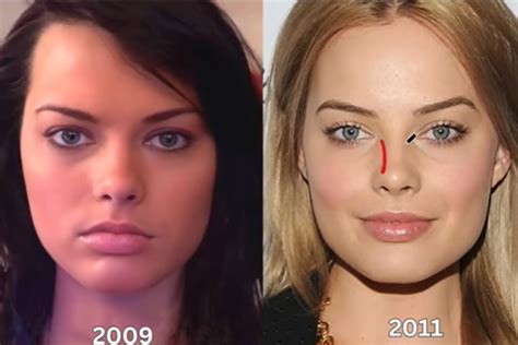 margot robbie lip filler|How many plastic surgeries did Margot Robbie get done to look。